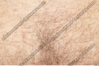 human skin hairy 0003